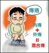 治疗痔疮去哪个医院好?「南宁医博」